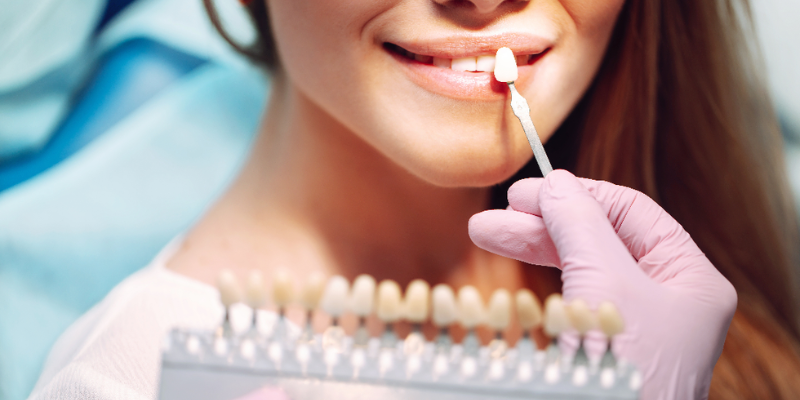 Keeping Your Veneers Looking Bright for Years