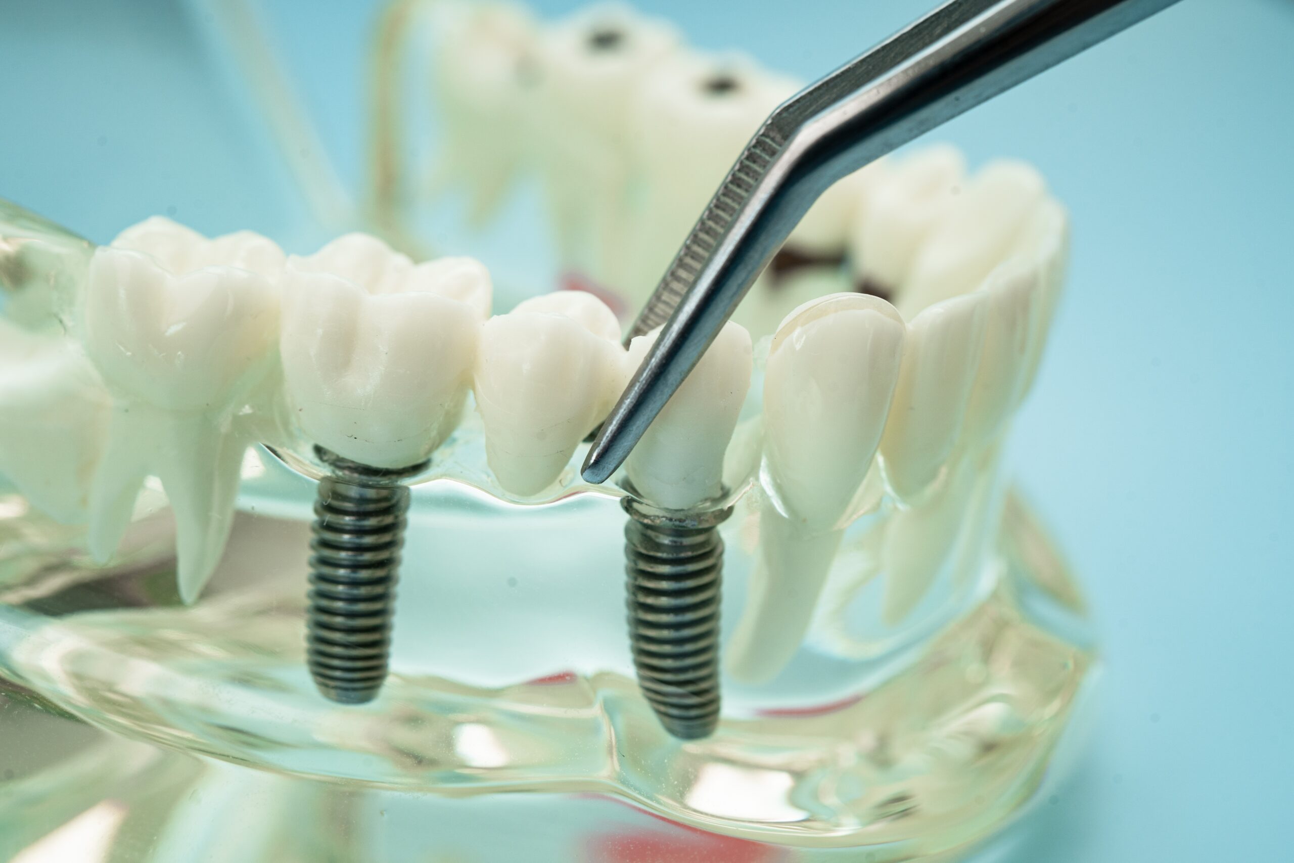 restorative dentistry in Tucson, Arizona